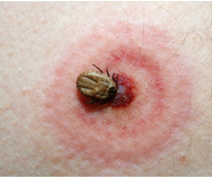 Lyme-kór ellen a 4 legkiválóbb gyógynövény